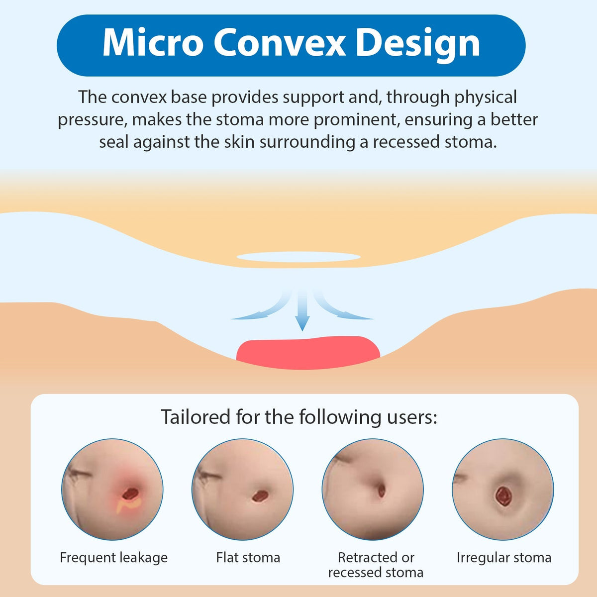 HEAGI 10 PCS Convex Ostomy Bag with Vent One-Piece Drainable Pouches Fits Retracted/Deep-Seated Stoma, Cut-to-Fit 20–57mm