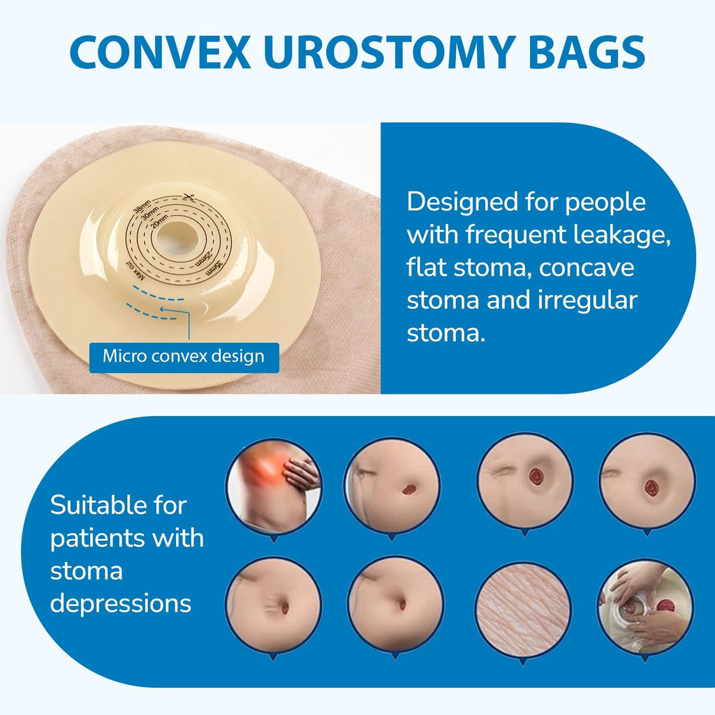 Onnohere 10 PCS Convex Urostomy Bags, One Piece Urostomy Pouches with Anti-Reflux System, 15–38mm