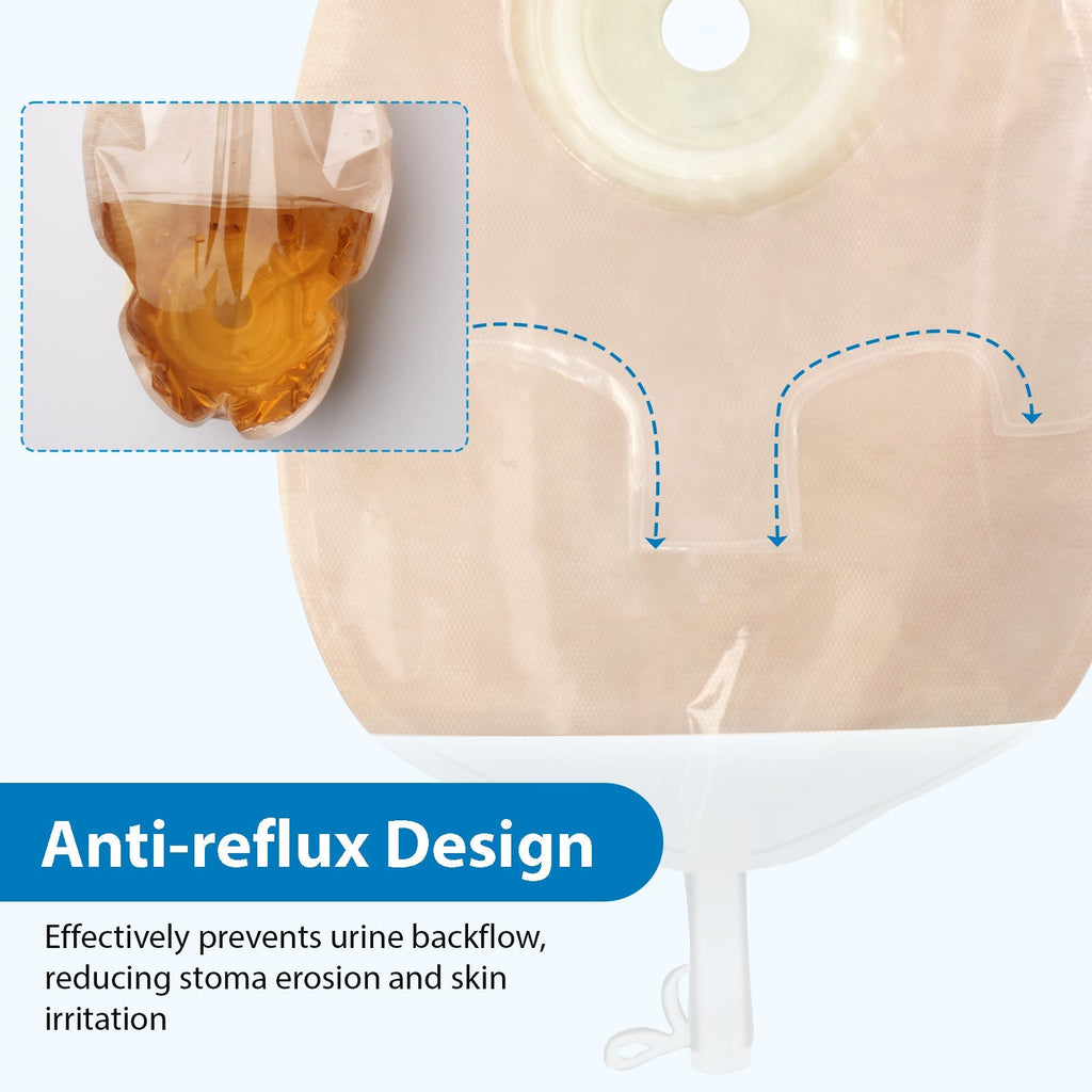 Onnohere 10 PCS Convex Urostomy Bags, One Piece Urostomy Pouches with Anti-Reflux System, 15–38mm