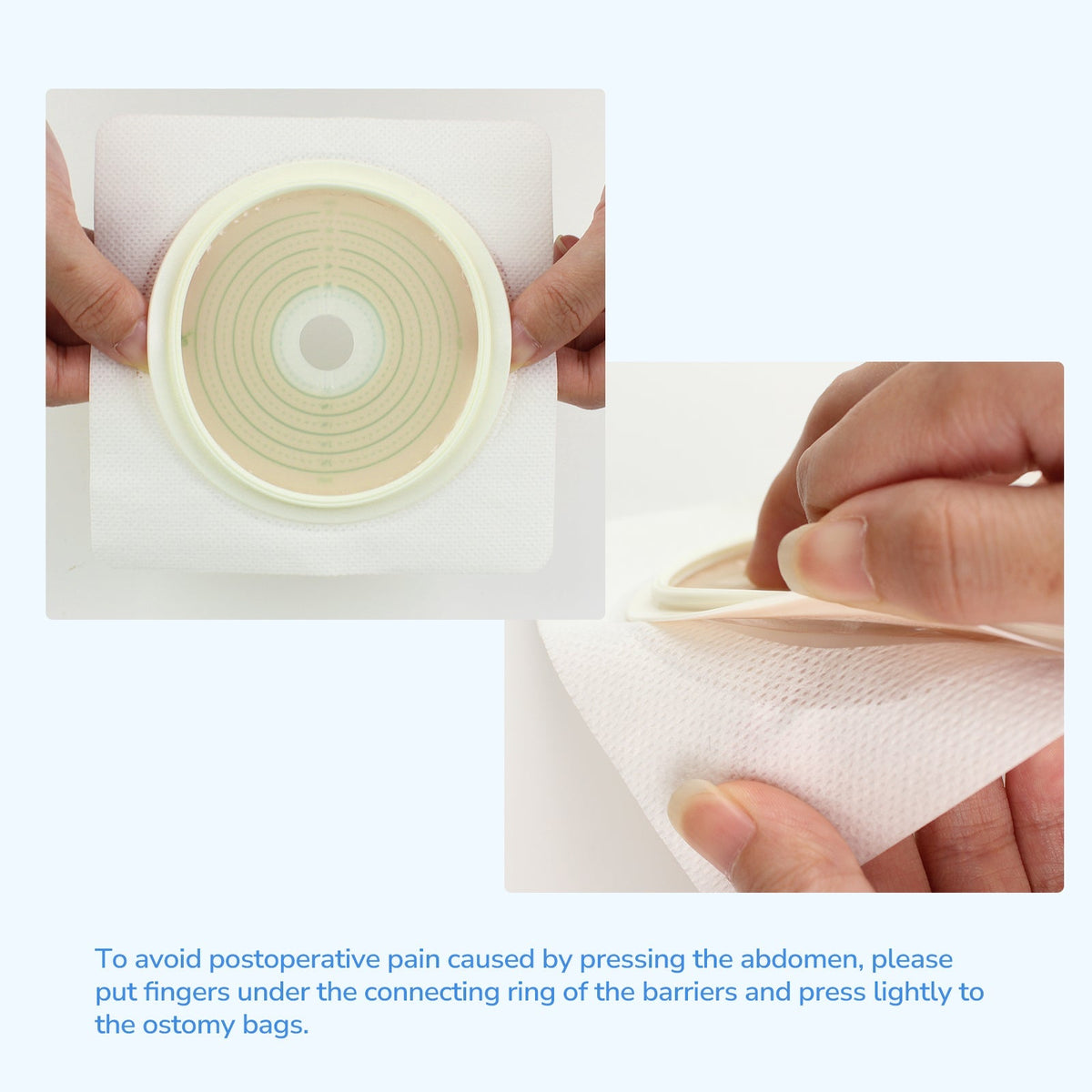 Onnohere 10Pcs Skin Barrier with Non-Woven Border Cut-to-Fit for 2-Piece Drainable Pouch Ostomy Wafers for Colostomy Ileostomy Stoma Care Supplies