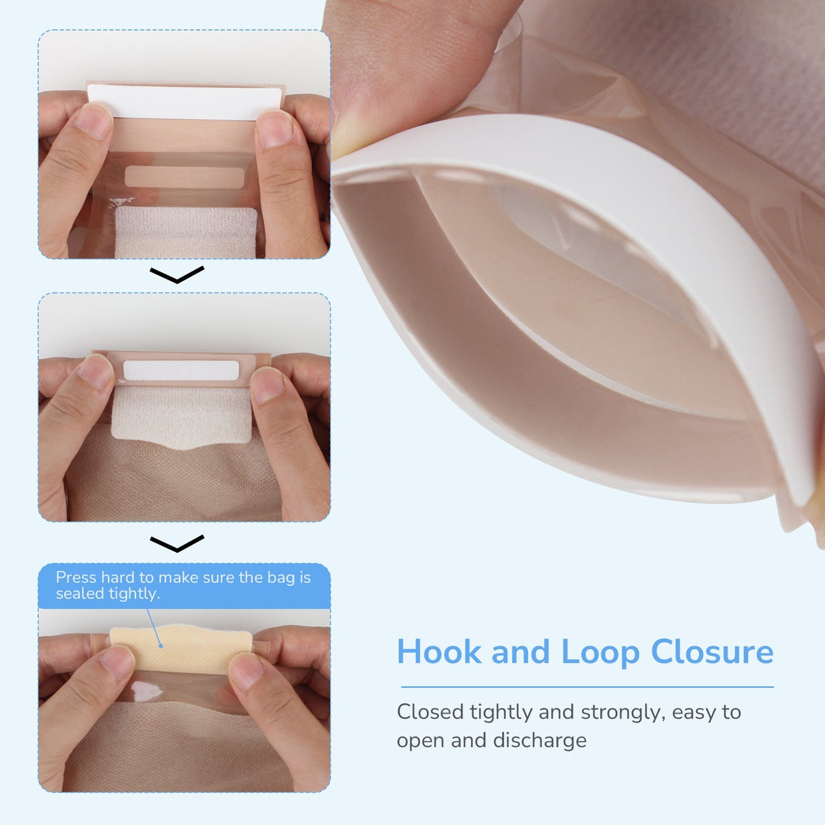 Onnohere 2-Piece Colostomy Bags  Drainable Pouches with Closure for Ileostomy Ostomy supplies
