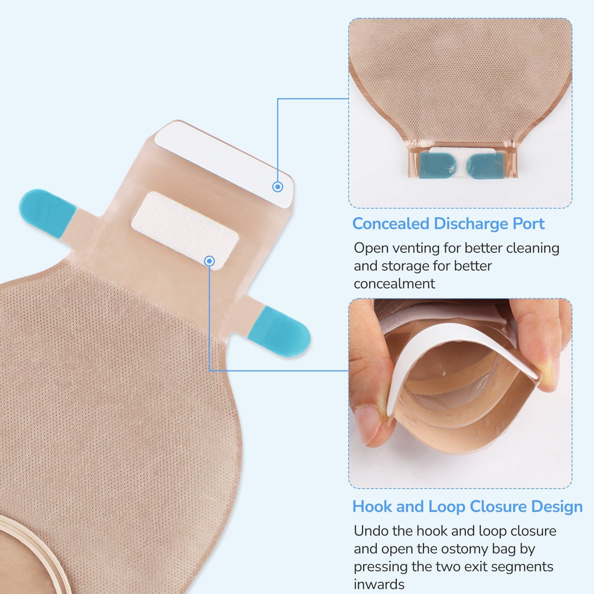 Onnohere 2-Piece Colostomy Bags with Exhaust Hole, Drainable Ostomy Pouch , Cut-to-Fit 20–70mm