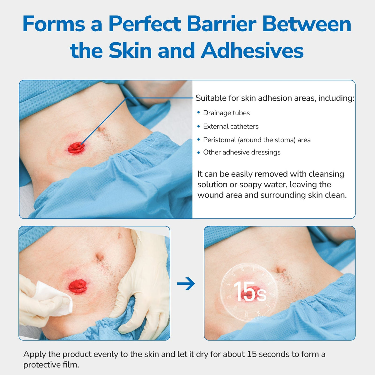 Onnohere 200 PCS Ostomy Skin Barrier Wipes Alcohol-Free Skin Prep Film for Stoma Care