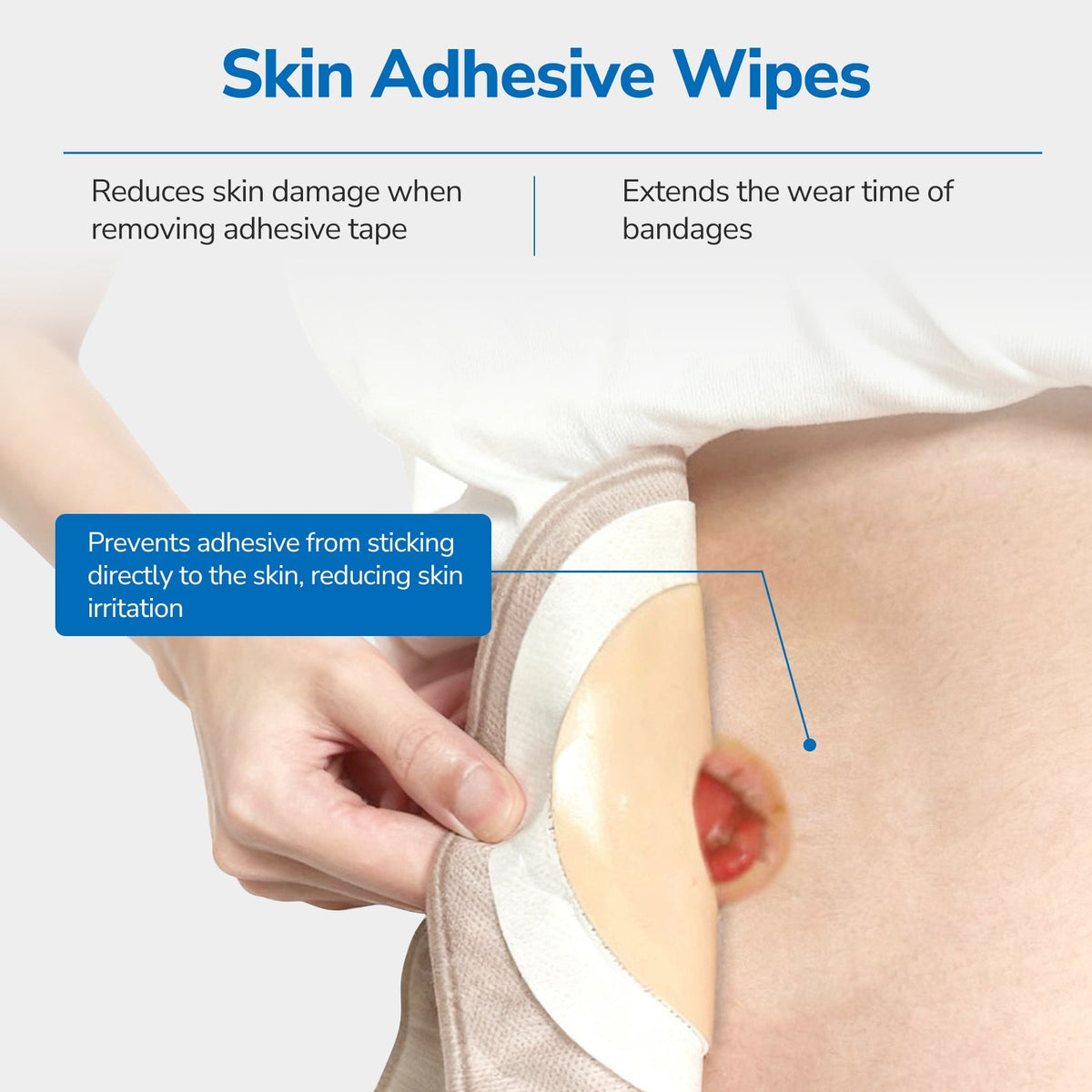 Onnohere 200 PCS Ostomy Skin Barrier Wipes Alcohol-Free Skin Prep Film for Stoma Care