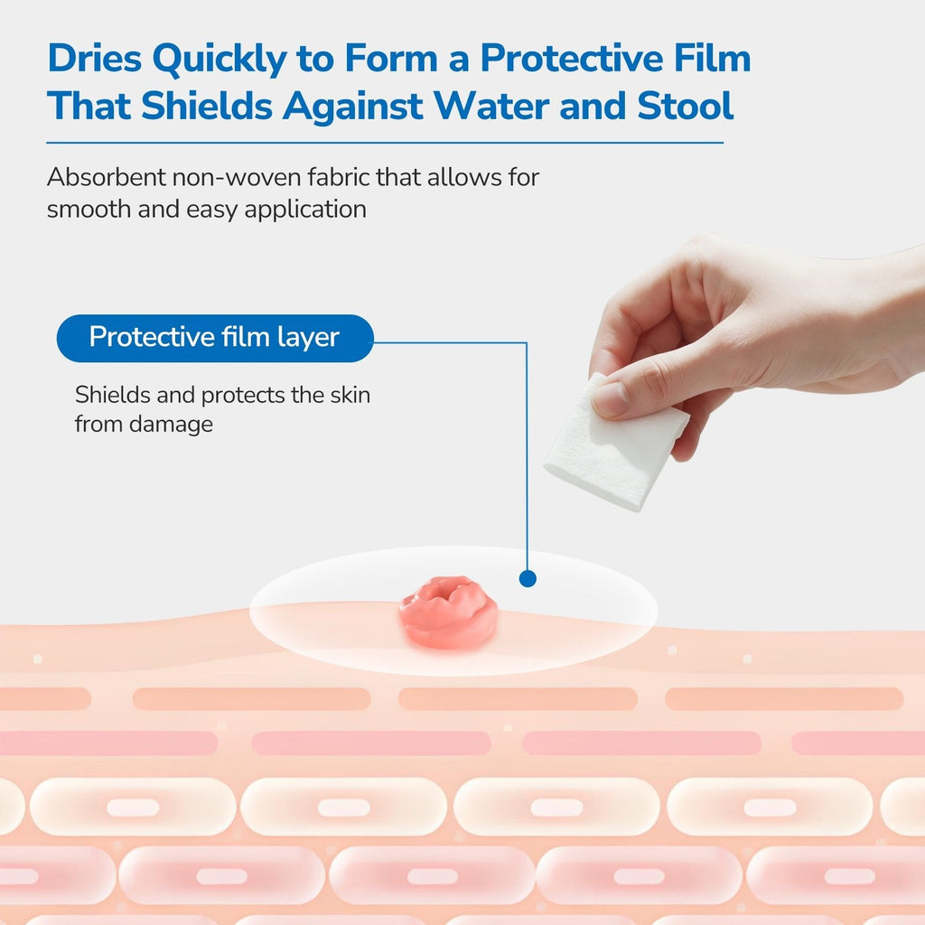 Onnohere 200 PCS Ostomy Skin Barrier Wipes Alcohol-Free Skin Prep Film for Stoma Care