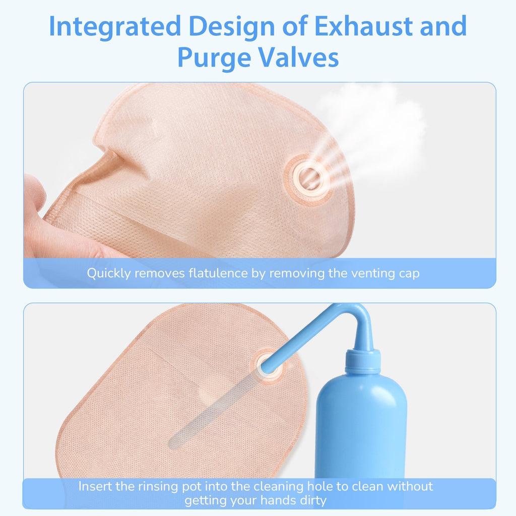 Onnohere 20Pcs Colostomy Bag Exhaust Holes for Ileostomy, One Piece Drainable Pouch Ostomy Care Supplies