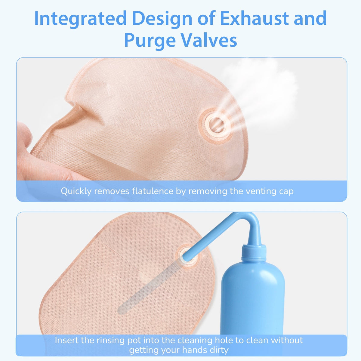 Onnohere 20Pcs Colostomy Bag Exhaust Holes for Ileostomy, One Piece Drainable Pouch Ostomy Care Supplies