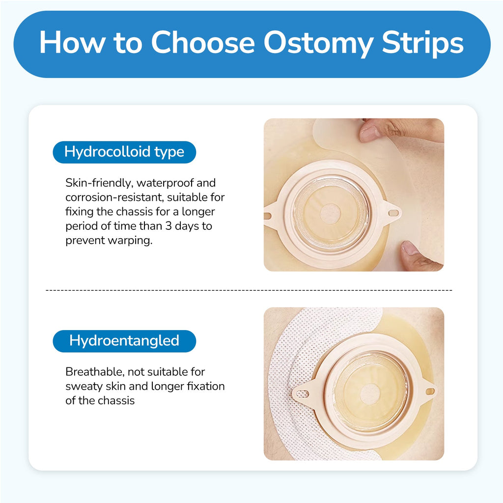Onnohere 20PCS Ostomy Barrier Strips, Skin-Friendly Hydrocolloid , Elastic Barrier Strips for Ostomy Bag Colostomy Ileostomy Supplies