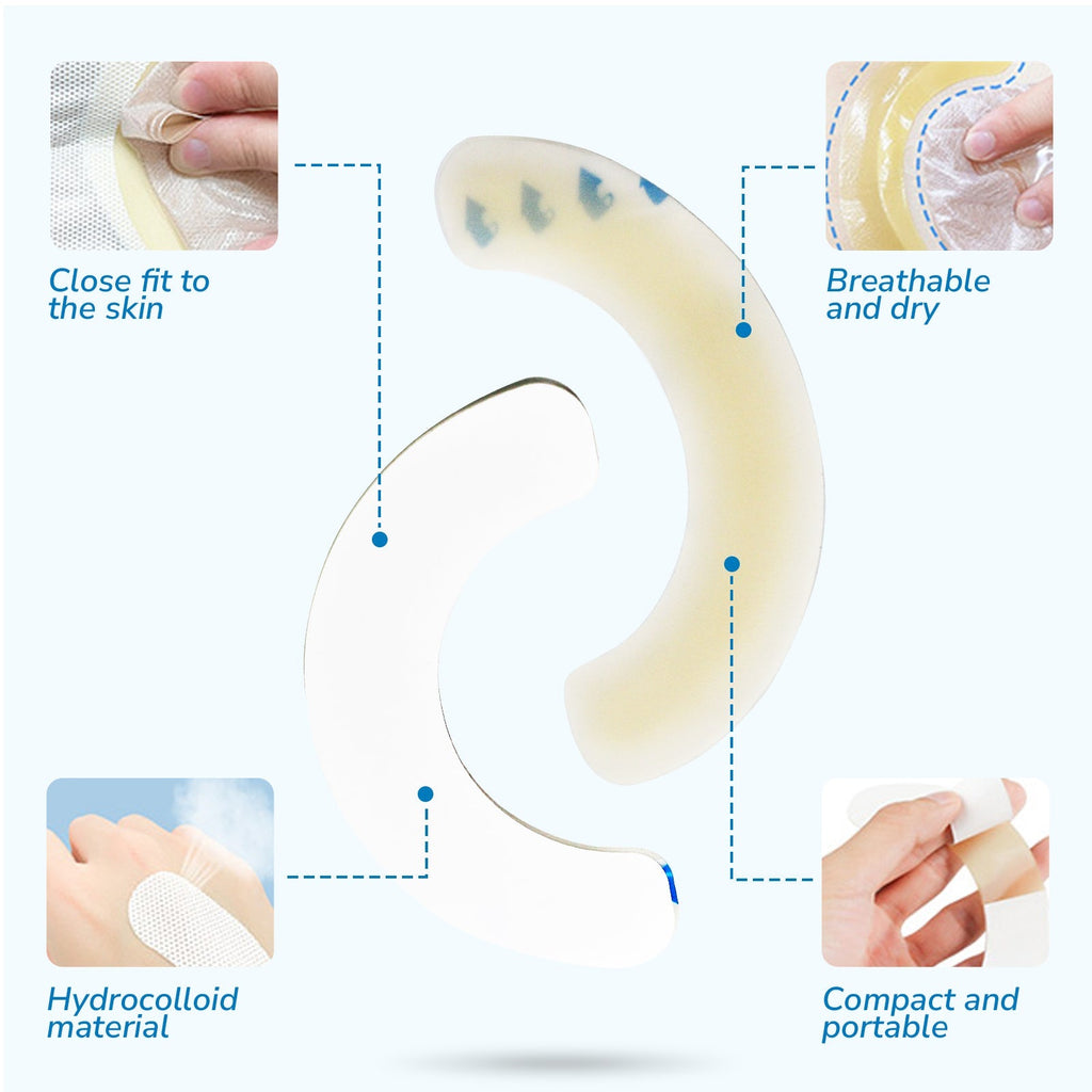 Onnohere 40PCS Elastic Barrier Strips for Ostomy Bag, Skin-Friendly Hydrocolloid Skin Barrier Strips,Osotmy Care