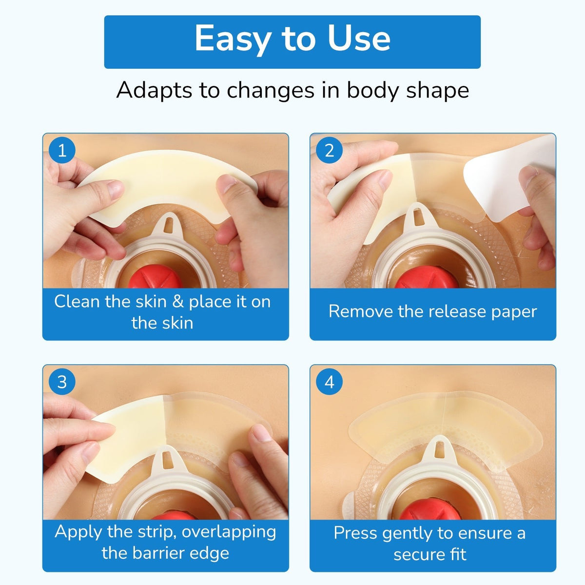 Onnohere 3-Piece Wide Ostomy Barrier Strips (30 PCS) – Hypoallergenic Hydrocolloid Sealing for Secure Fit