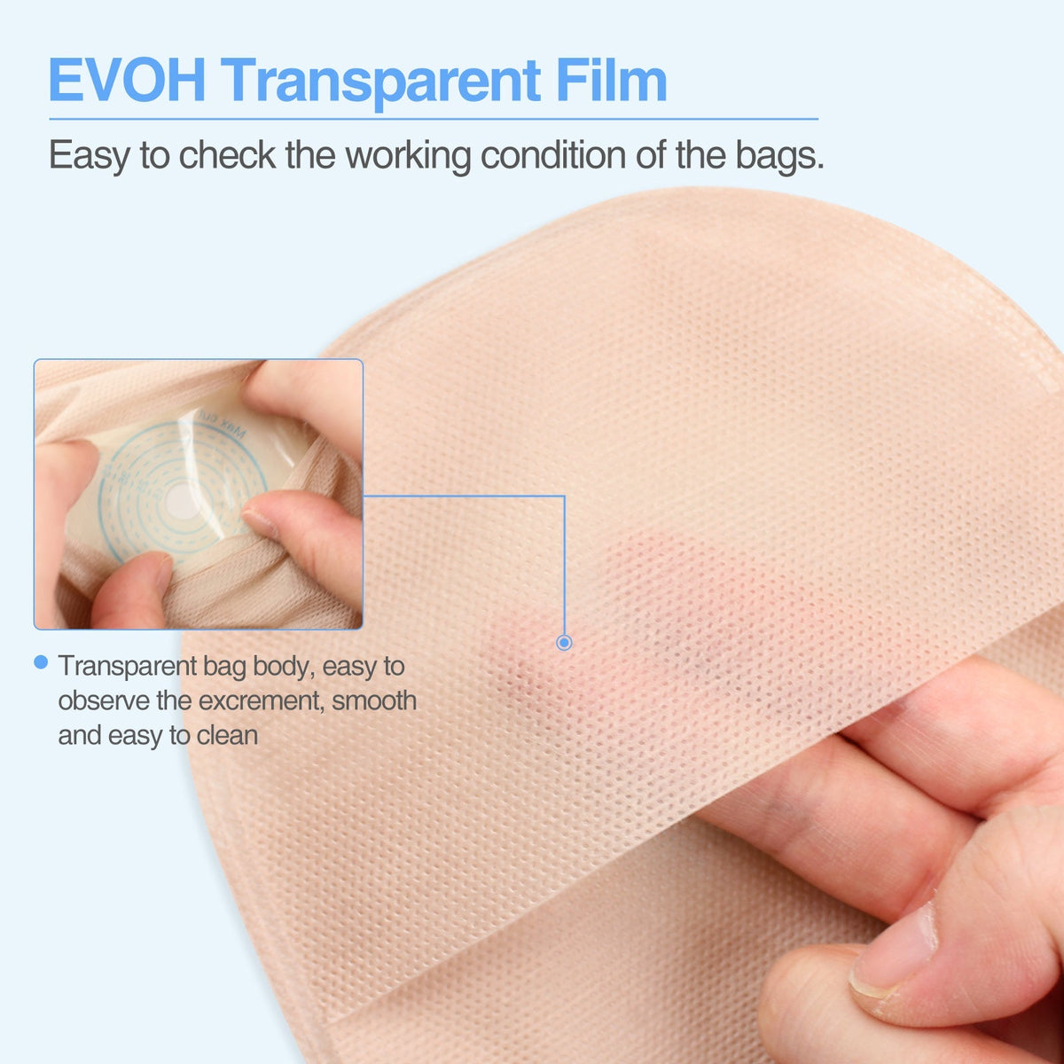Onnohere 30 PCS Urostomy Bag, One-Piece Drainable Urostomy Supplies
