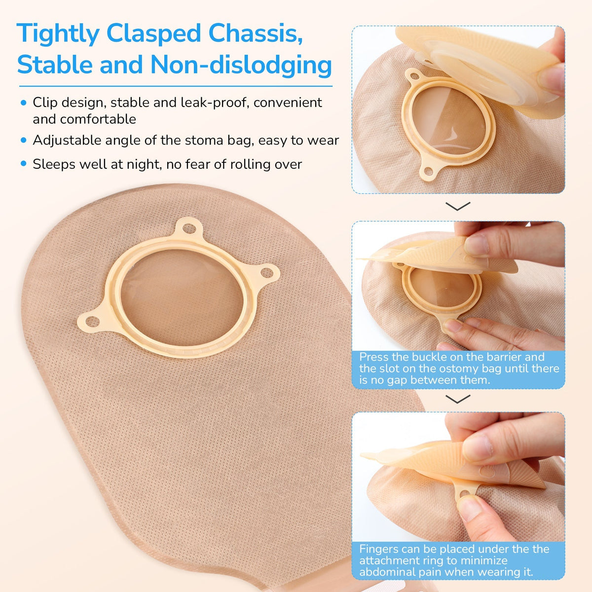 Onnohere 30pcs 2 Piece Convex Colostomy Bags 15-45mm Drainable Pouches with Closure for Ileostomy Ostomy supplies