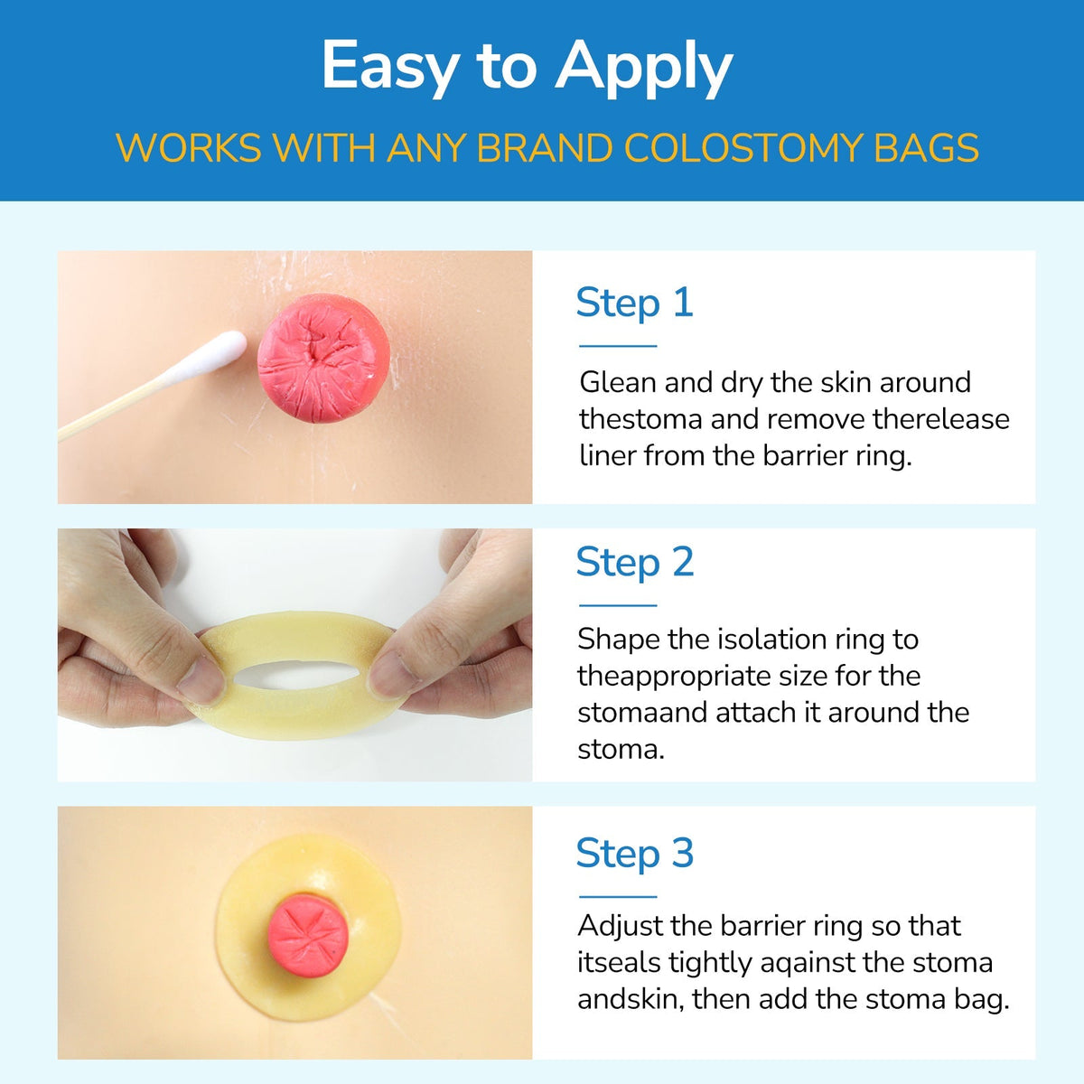 Onnohere 2mm Ostomy Barrier Rings – Hydrocolloid Moldable Seal for Leak Protection & Skin Comfort, Ostomy Care