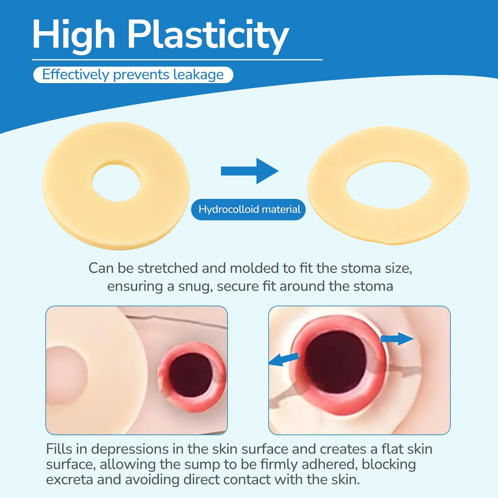 Onnohere 4mm Ostomy Barrier Rings – Thick Hydrocolloid Seal for Enhanced Leak Protection, Ostomy Care