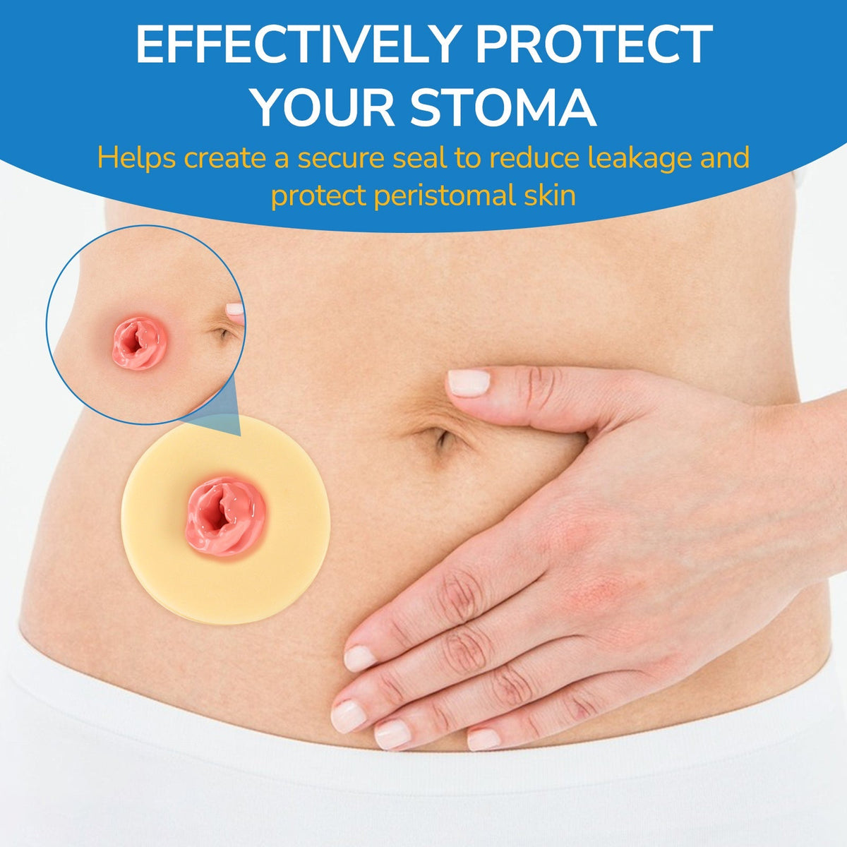 Onnohere 2mm Ostomy Barrier Rings – Hydrocolloid Moldable Seal for Leak Protection & Skin Comfort, Ostomy Care