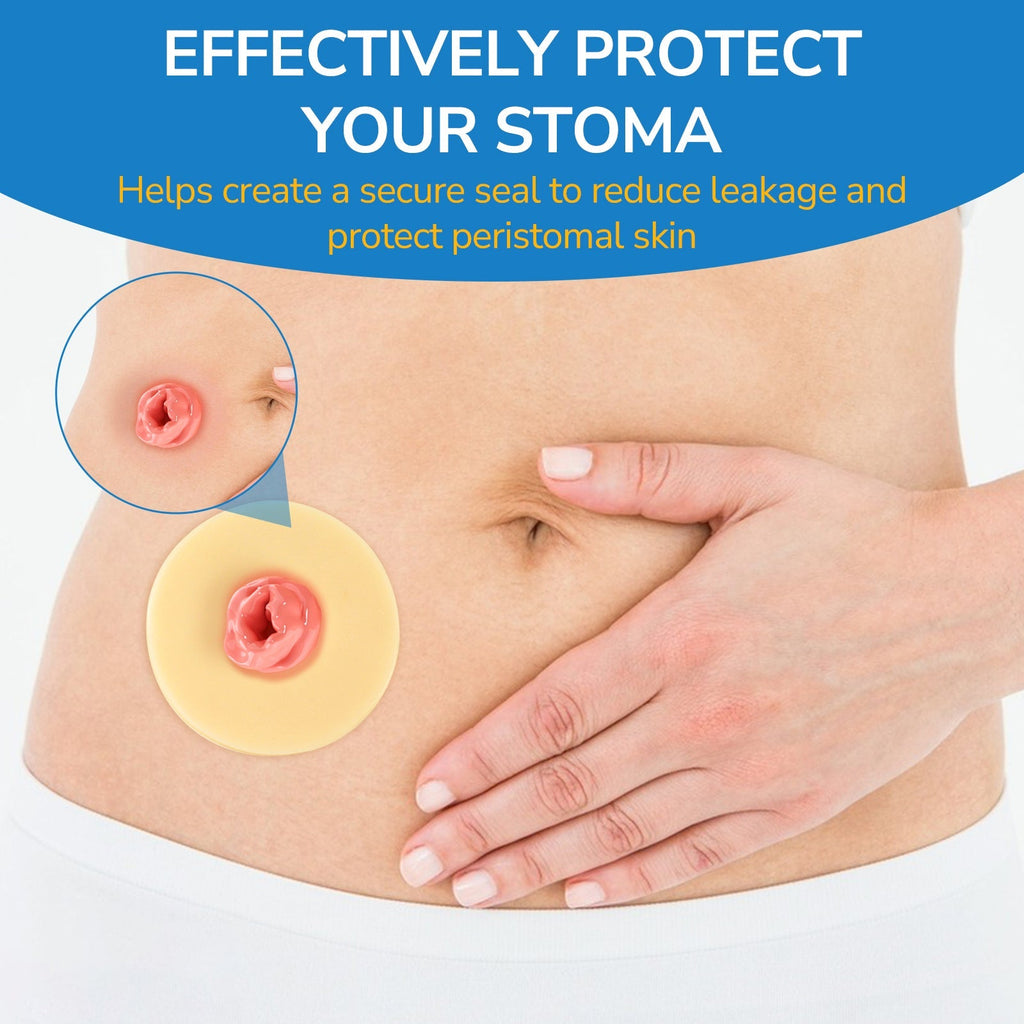 Onnohere 4mm Ostomy Barrier Rings – Thick Hydrocolloid Seal for Enhanced Leak Protection, Ostomy Care