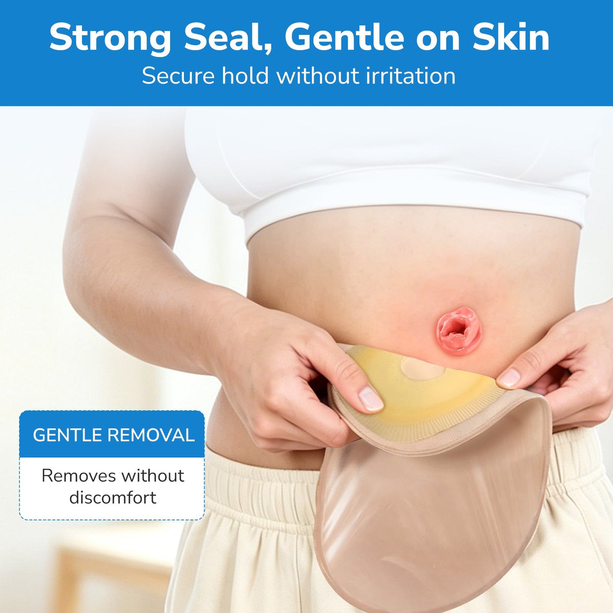 Onnohere 50 Pack Closed Ostomy Bags – One-Piece Disposable Colostomy Pouches, Cut-to-Fit 20–60mm