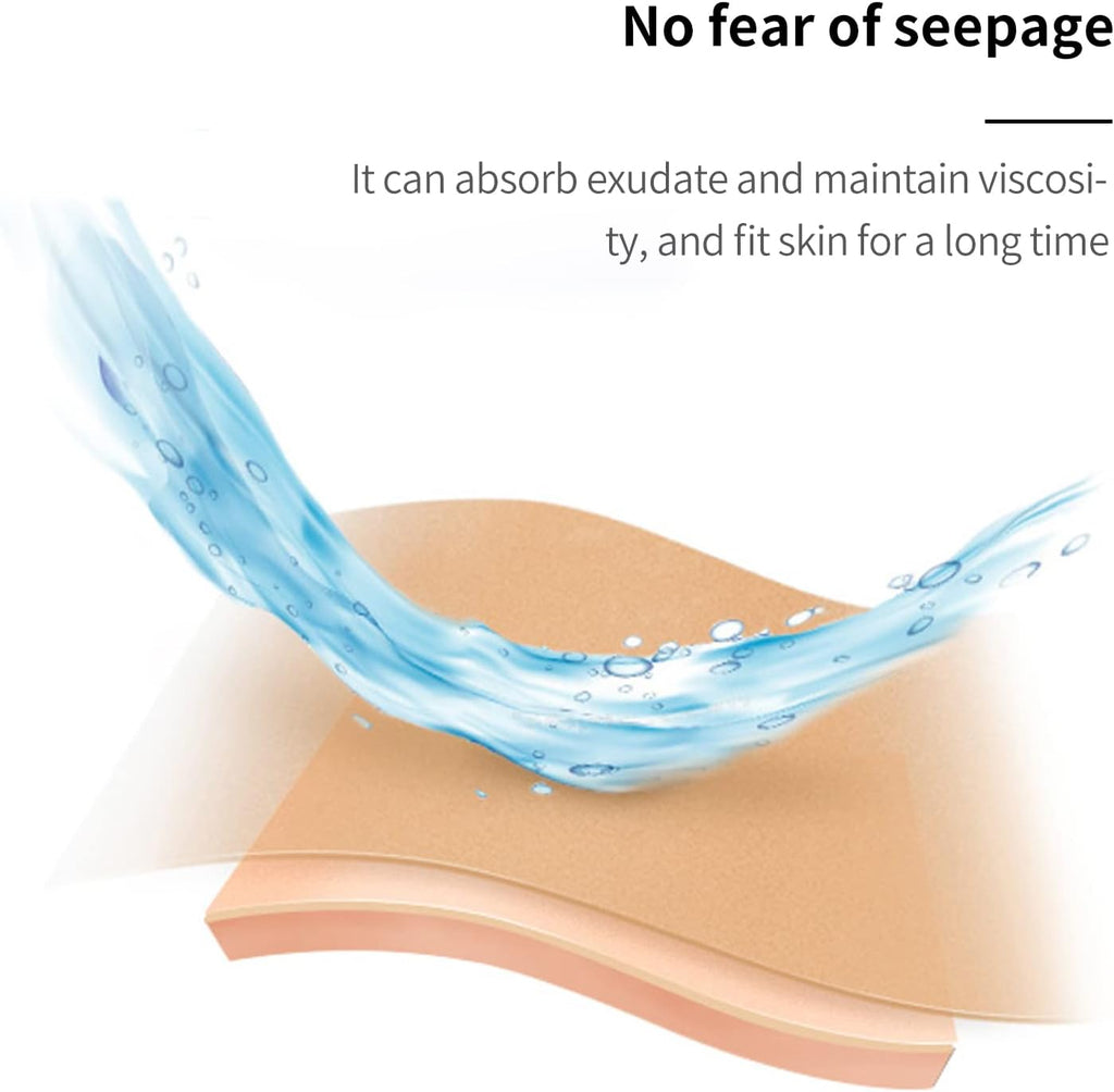 Onnohere Alcohol-Free Ostomy Paste - Skin Barrier Protection for Stoma Care, Colostomy Supplies Accessories