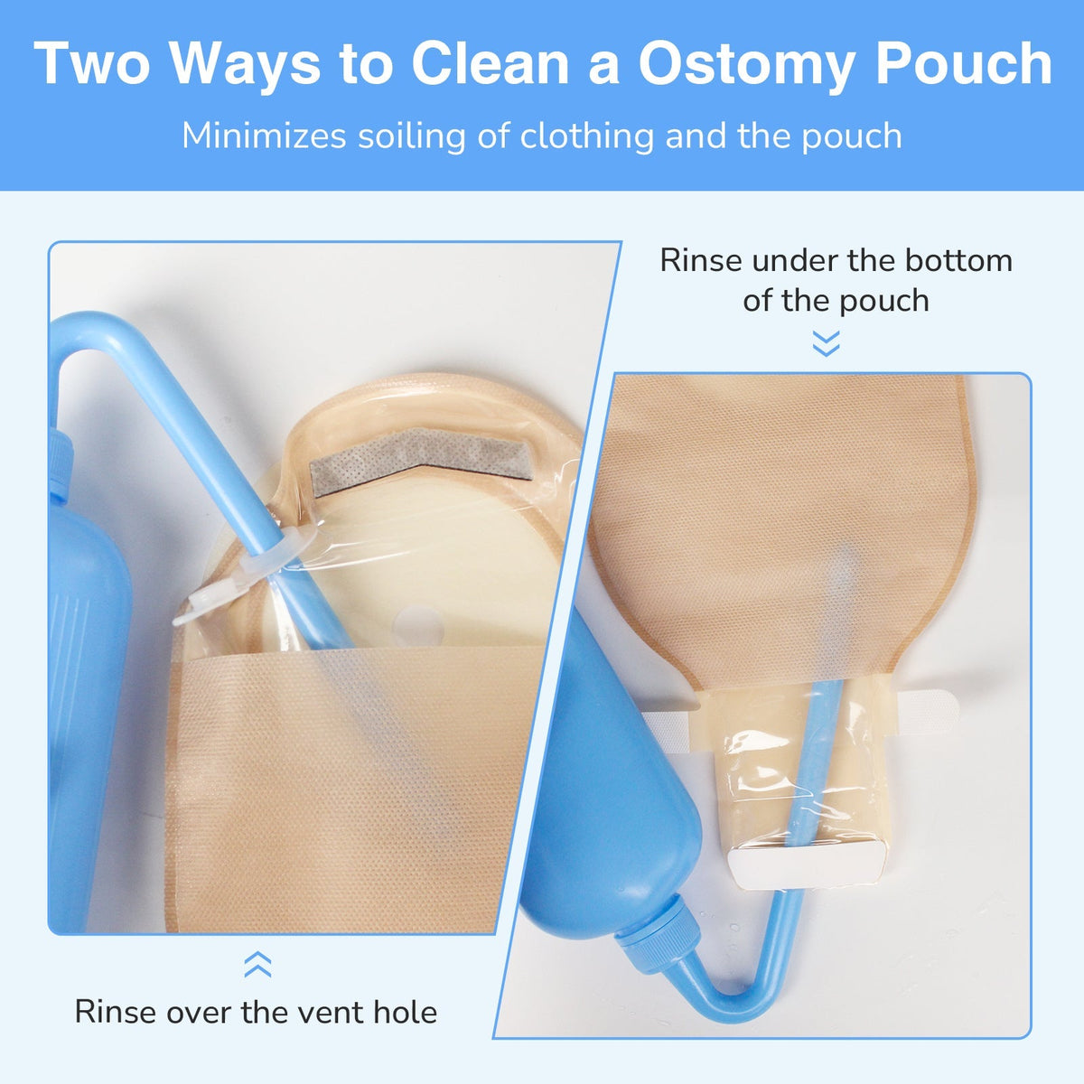 Onnohere One-Piece Colostomy Bags with Dual Vent System, 15–85mm Drainable Pouches Ostomy Supplies 20PCS