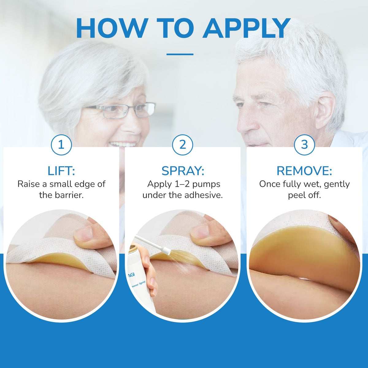 Onnohere Ostomy Adhesive Remover Spray – No-Sting Skin-Friendly Spray for Gentle Adhesive Removal (50ml) Ostomy Care