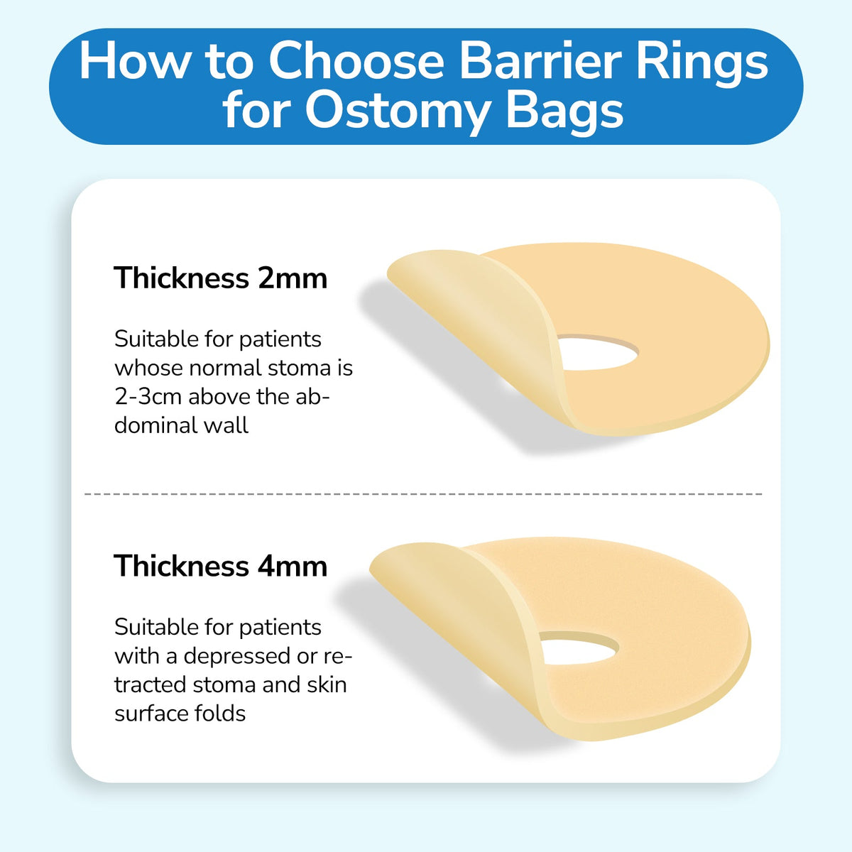 Onnohere Ostomy Barrier Rings Ostomy Supplies 2mm Thickness Moldable Ostomy Rings Medical Grade Hydrocolloid Adhesive