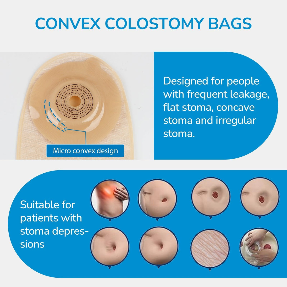 Onnohere 2 Piece Convex Colostomy Bags For Ileostomy Ostomy Pouch with Clamp