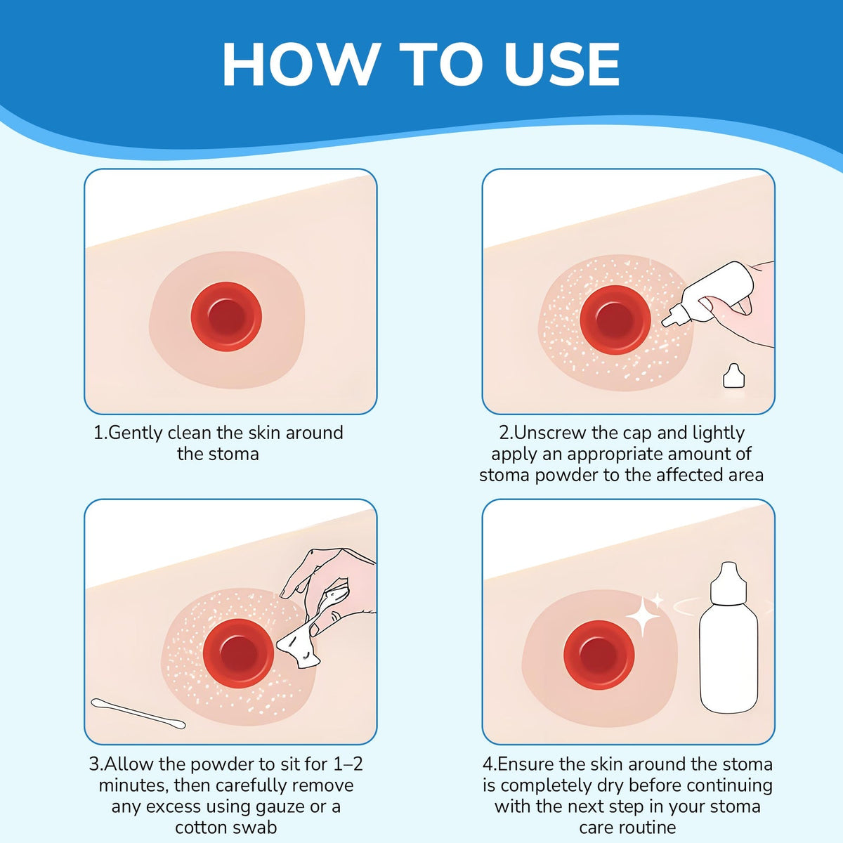 Onnohere Stoma Powder, Ostomy Skin Care Powder, Protects Skin Keep Dry Ostomy Powder Adapt Stoma Powder (25g)