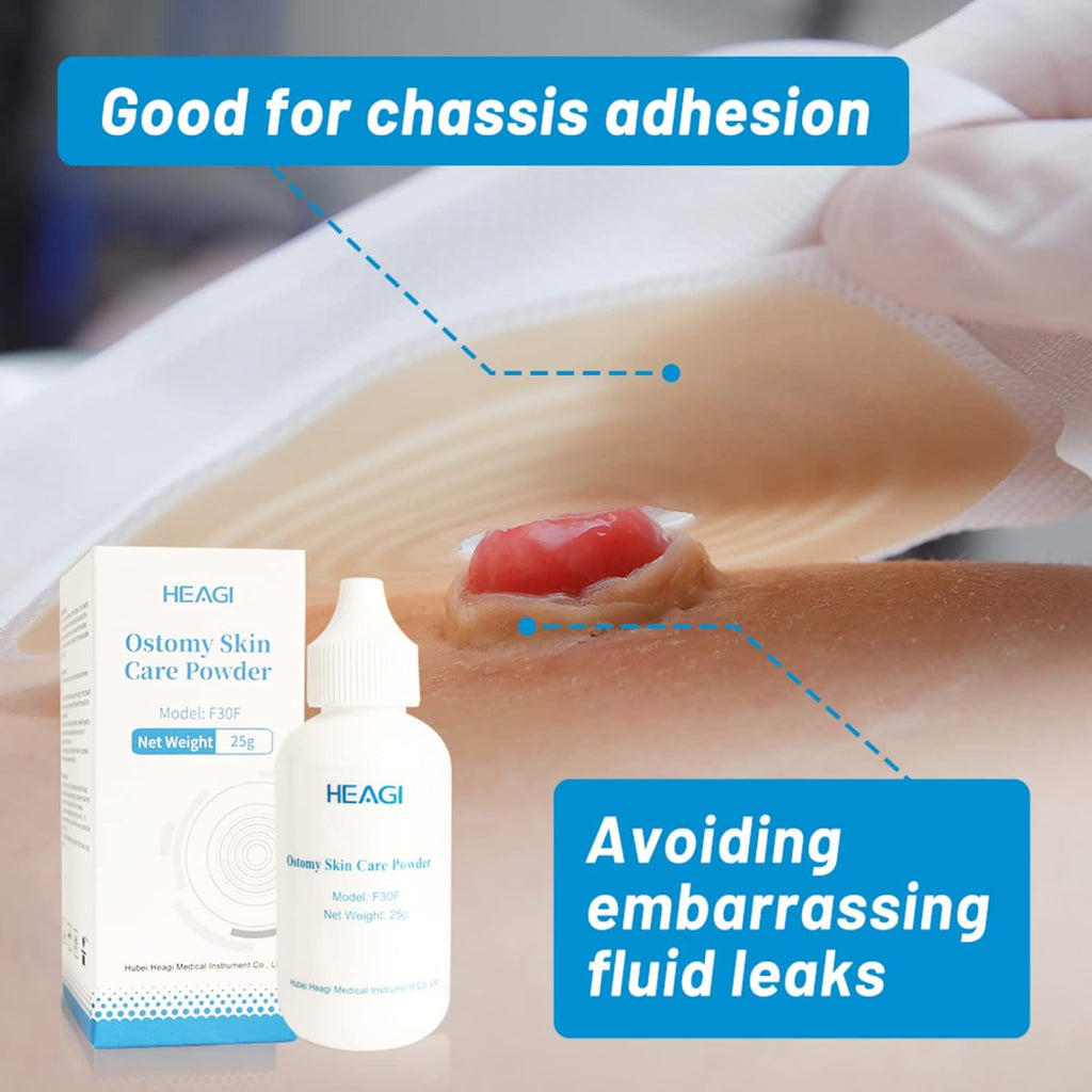Onnohere Stoma Powder, Ostomy Skin Care Powder, Protects Skin Keep Dry Ostomy Powder Adapt Stoma Powder (25g)