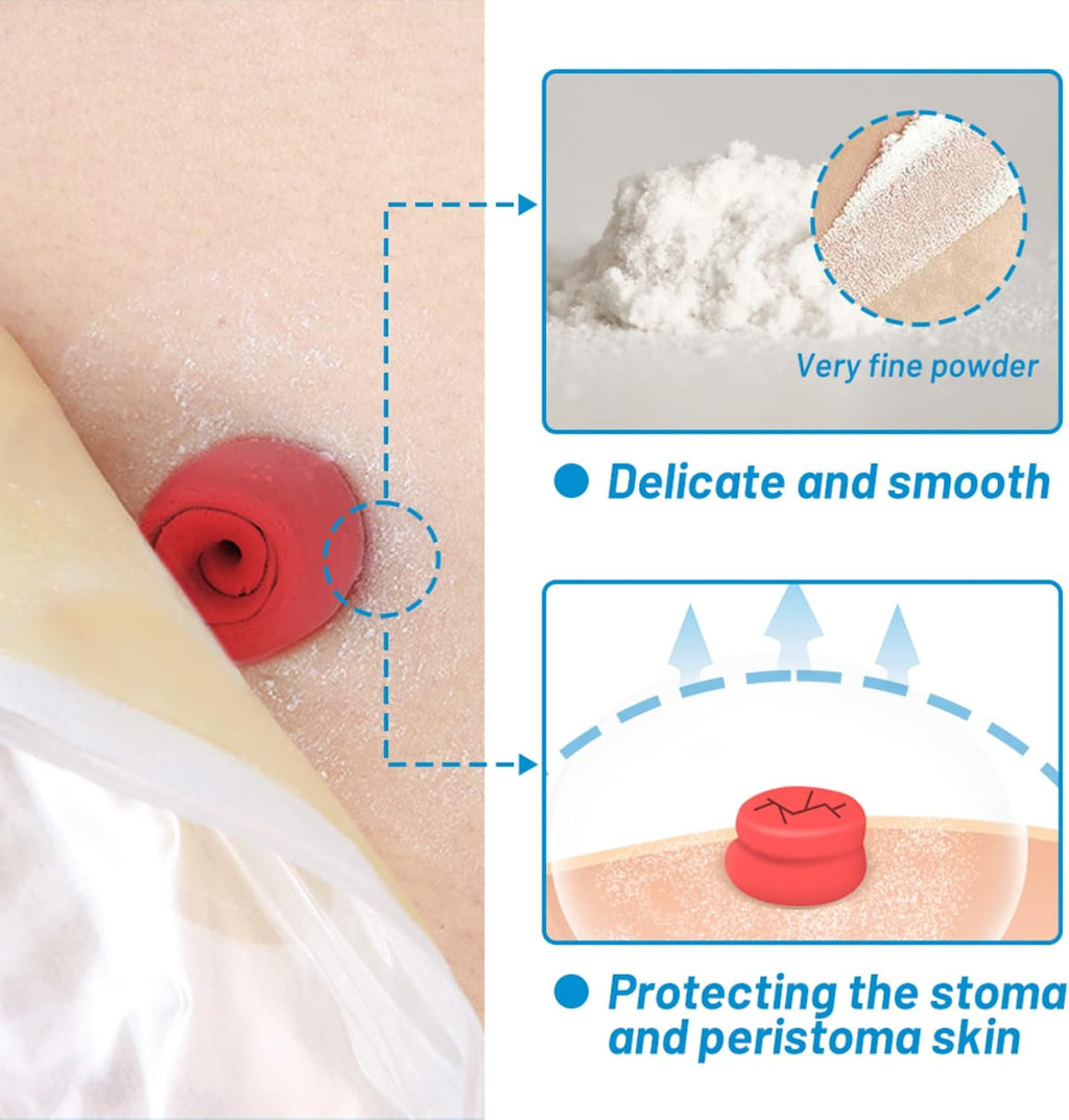 Onnohere Stoma Powder, Ostomy Skin Care Powder, Protects Skin Keep Dry Ostomy Powder Adapt Stoma Powder (25g)