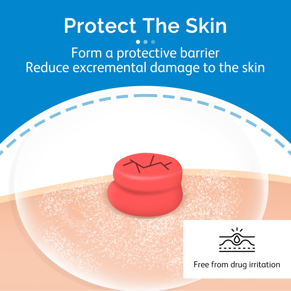 Onnohere Stoma Powder, Ostomy Skin Care Powder, Protects Skin Keep Dry Ostomy Powder Adapt Stoma Powder (25g)